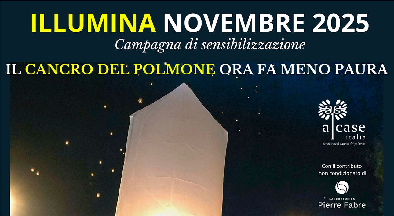 Cover Alcase italia illumina novembre